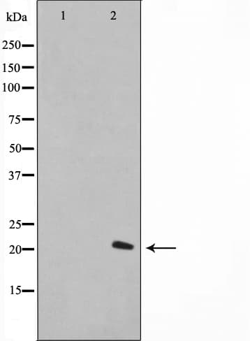 Polyclonal Rabbit anti-Human H1F0 Antibody (IF, WB)