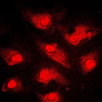 FOXO1 / FKHR Antibody (Internal)