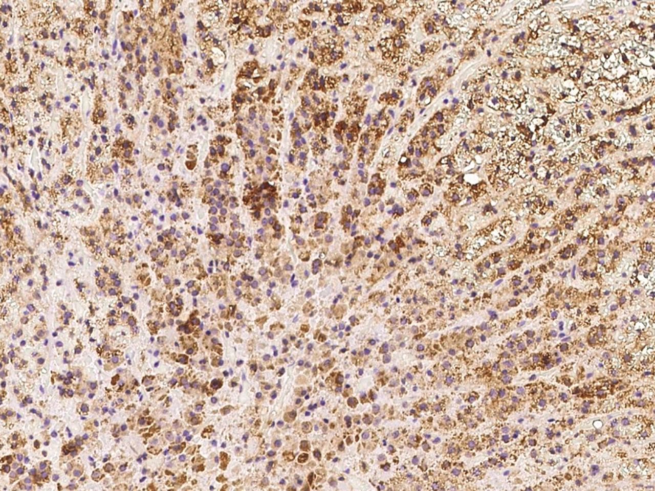 KIAA1344 / TXNDC16 Antibody