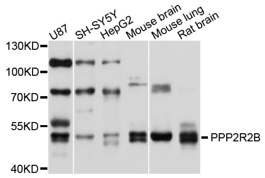 PPP2R2B Antibody