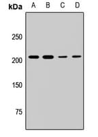 Polyclonal Rabbit anti-Human KMT2E / MLL5 Antibody (IF, WB)