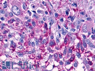 PathPlus™ Polyclonal Rabbit anti-Human GPR68 / OGR1 Antibody (C-Terminus, IHC)