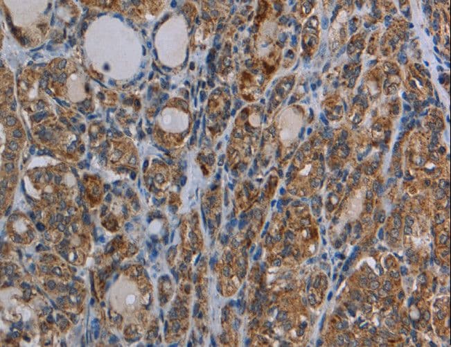 MYO7A / Myosin-VIIa Antibody