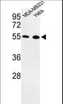 Polyclonal Rabbit anti-Human EGLN2 / PHD1 Antibody (aa194-221, IHC, WB)