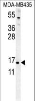 Polyclonal Rabbit anti-Human ENY2 Antibody (aa2-31, WB)