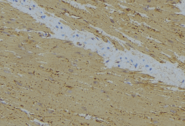 Polyclonal Rabbit anti-Human MRPL24 Antibody (IHC, IF, WB)