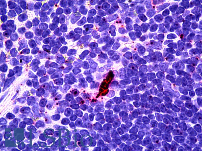 IHC-plus™ Monoclonal Rat anti-Mouse EBI3 / IL-27B Antibody (clone DNT27, IHC, WB)