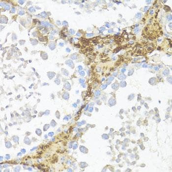 Polyclonal Rabbit anti-Human AMH / Anti-Mullerian Hormone Antibody (IHC)