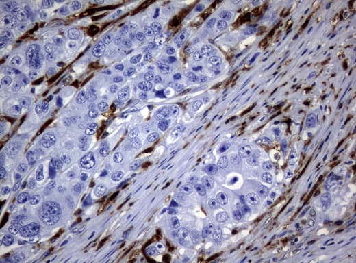 TP / Thymidine Phosphorylase Antibody (aa311-482, clone UMAB98)