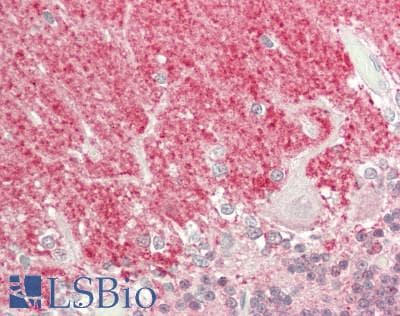 PathPlus™ ENO2 / NSE Antibody (C-Terminus)
