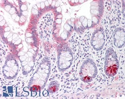 IHC-plus™ Polyclonal Rabbit anti-Human GUCA2A / Guanylin Antibody (IHC, WB)