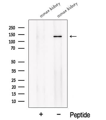 SLC12A1 / NKCC2 Antibody