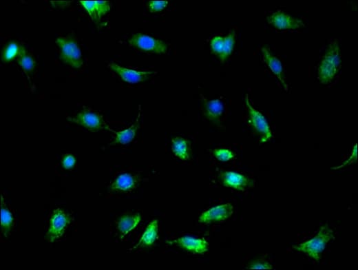 Polyclonal Rabbit anti-Human TRADD Antibody (IHC, IF, WB)