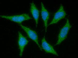 Monoclonal Mouse anti-Human IGF1 Antibody (clone AT6F8, WB)