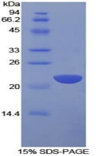 Human IL1A / IL-1 Alpha Protein (Recombinant His-T7)