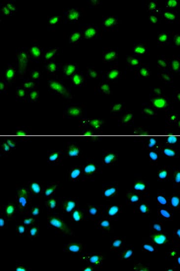 LETMD1 / HCCR1 Antibody