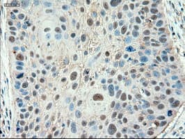 PTCH1 / Patched 1 Antibody (clone OTI5C7)