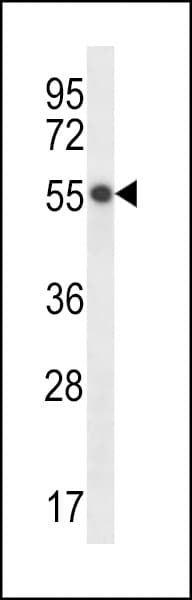 HEPACAM Antibody (aa298-327)