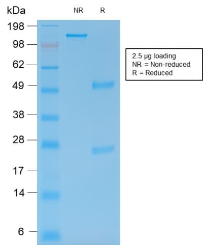 MMP9 / Gelatinase B Antibody (clone rMMP9/1769, Azide-free, Carrier-free)