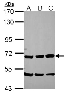 IHC-plus™ Polyclonal Rabbit anti-Human SCG2 / Secretogranin II Antibody (aa272-542, IHC, WB)