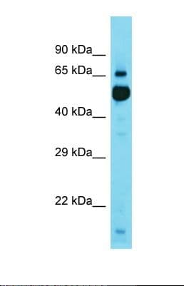 KBTBD11 Antibody (aa545-594)