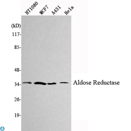 Monoclonal Mouse anti-Human AKR1B1 / Aldose Reductase Antibody (WB)