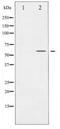 PPARG / PPAR Gamma Antibody