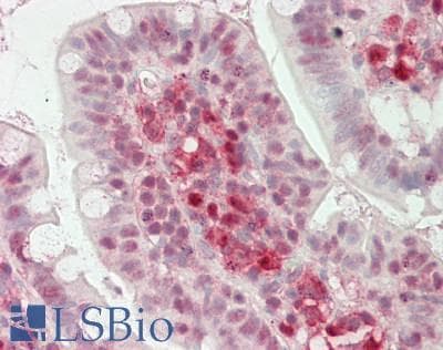 IHC-plus™ Monoclonal Mouse anti-Human LGALS9 / Galectin 9 Antibody (clone 1G3, IHC, WB)