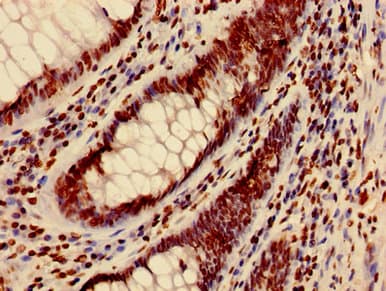HIST1H3A Antibody