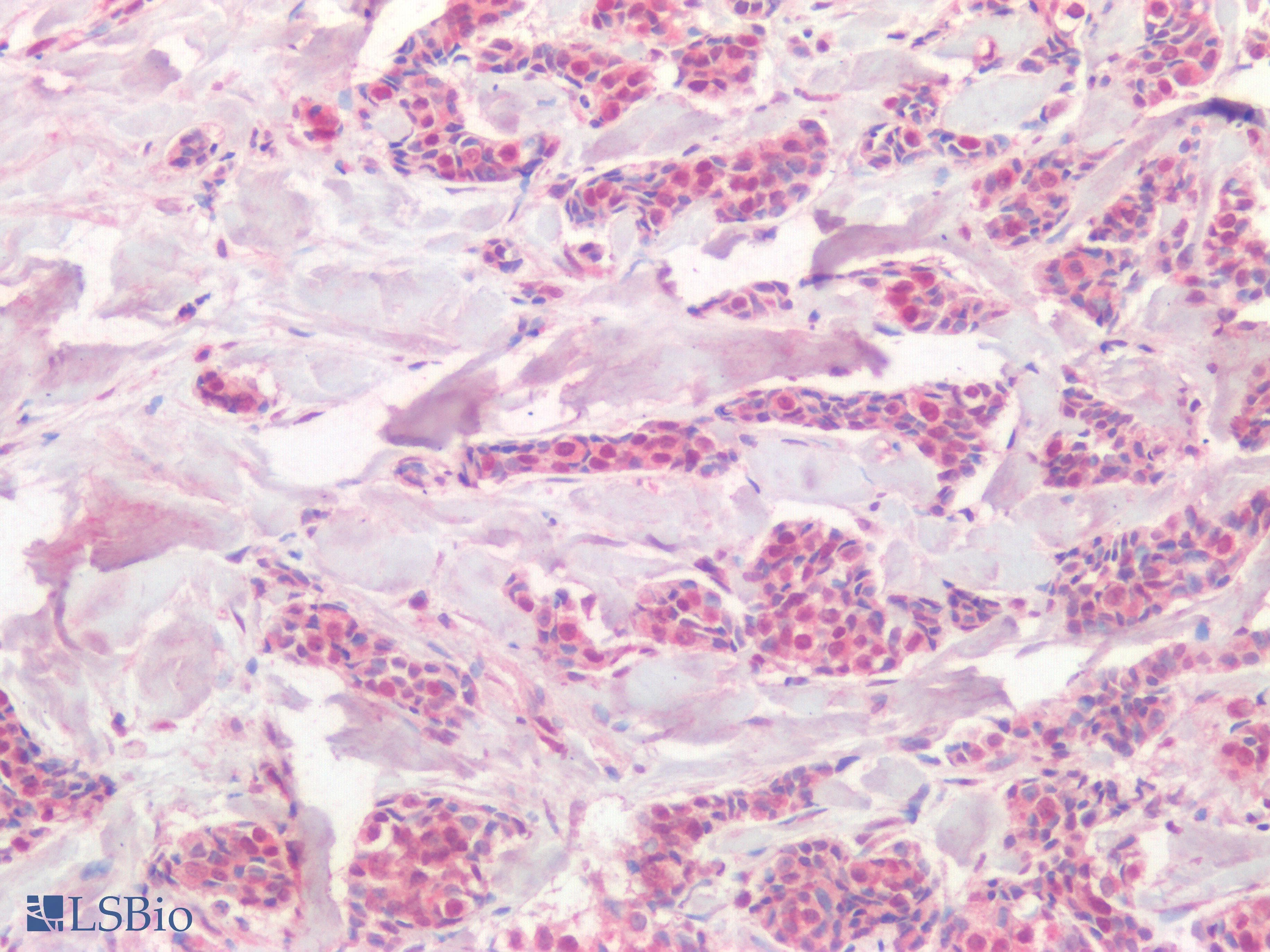 IHC-plus™ Polyclonal Rabbit anti-Human PIK3CA / PI3K Alpha Antibody (IHC)
