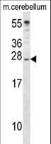 IGF2 Antibody (aa39-68)