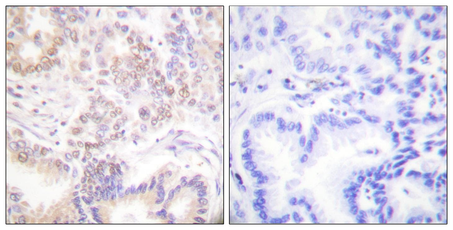 Polyclonal Rabbit anti-Human SENP5 Antibody (IHC, WB)