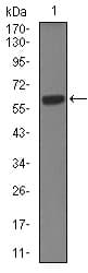 KRT5 / CK5 / Cytokeratin 5 Antibody (aa316-590, clone 10C11E6)