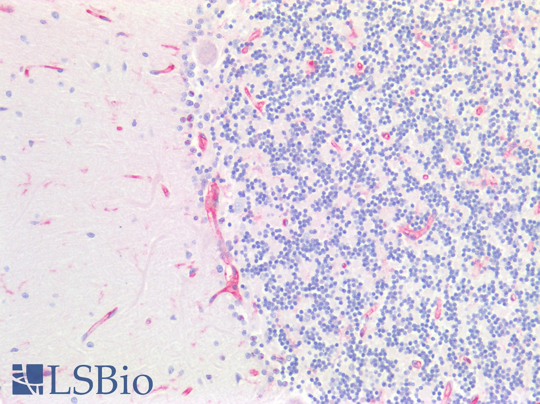 IHC-plus™ B2M / Beta 2 Microglobulin Antibody