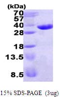 Human ECHDC1 Protein (Recombinant His)