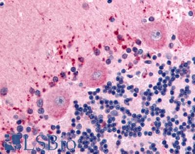 IHC-plus™ Polyclonal Rabbit anti-Human CELSR3 Antibody (N-Terminus, IHC)