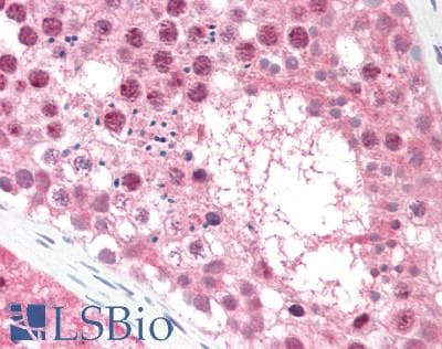IHC-plus™ Polyclonal Goat anti-Human GPS1 / CSN1 Antibody (aa516-527, IHC, WB)