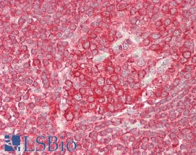 IHC-plus™ Polyclonal Rabbit anti-Human EEF2 / Elongation Factor 2 Antibody (aa2-858, IHC)