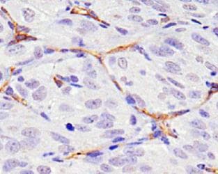 CD34 Antibody (clone MEC14.7)