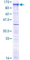 Human MCPH1 Protein (Recombinant GST)