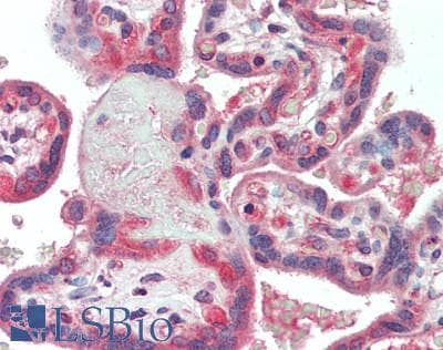 IHC-plus™ Polyclonal Rabbit anti-Human SLC31A2 Antibody (IHC)