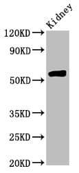 HMGCS2 / HMG-CoA Synthase 2 Antibody