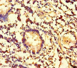 Polyclonal Rabbit anti-Human Carboxylesterase 3 / CES3 Antibody (IHC, IF)