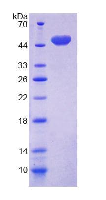 Human CD164 Protein (Recombinant His-GST)
