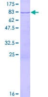 Human WDR48 Protein (Recombinant GST)