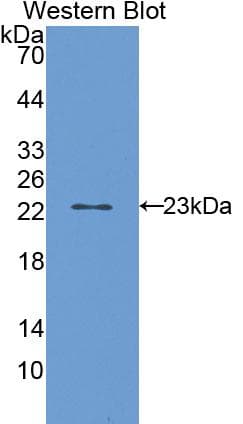 CYP2E1 Antibody (aa126-309)