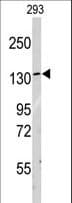 LARS / Leucyl-TRNA Synthetase Antibody (aa1118-1145)