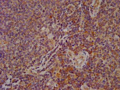 ESYT2 / E-Syt2 Antibody