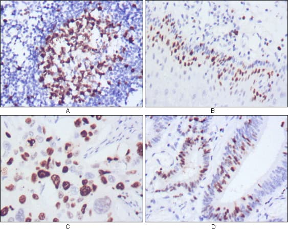 Monoclonal Mouse anti-Human NIFK / MKI67IP Antibody (clone 4A1, IHC)