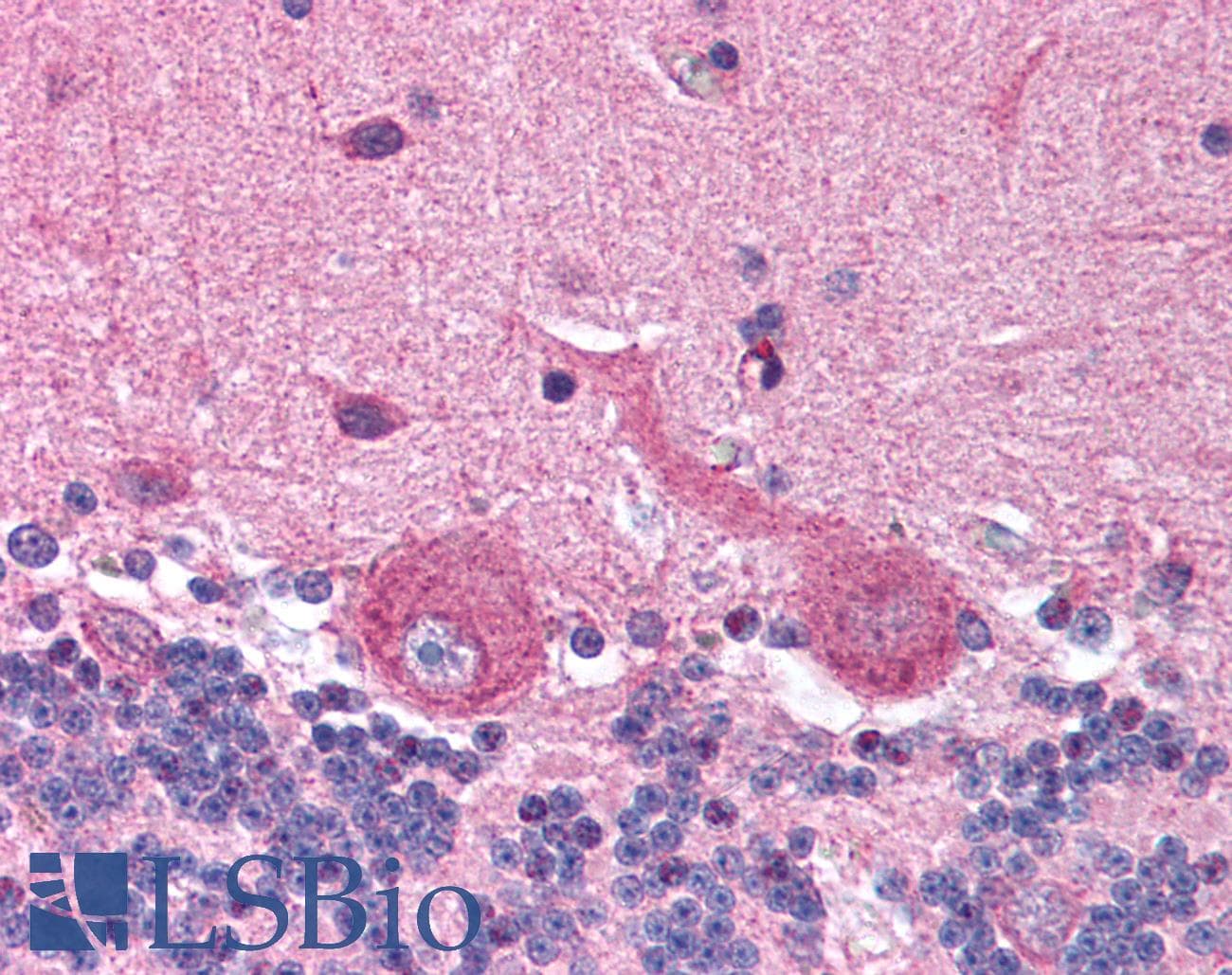 IHC-plus™ PLIN3 / M6PRBP1 / TIP47 Antibody (aa1-100)